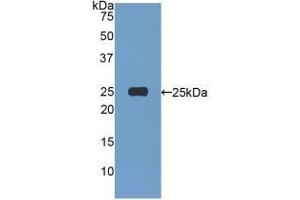 WB of Protein Standard: different control antibodies  against Highly purified E. (Afamin ELISA 试剂盒)