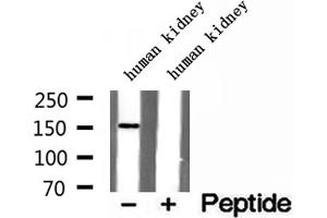 Western blot analysis of extracts of human kidney tissue, using RPGRIP1L antibody. (RPGRIP1L 抗体  (N-Term))