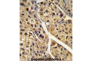Immunohistochemistry (IHC) image for anti-Peroxisomal Biogenesis Factor 11 alpha (PEX11A) antibody (ABIN3004001) (PEX11A 抗体)