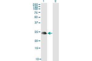Western Blot analysis of TSC22D3 expression in transfected 293T cell line by TSC22D3 monoclonal antibody (M01), clone 3A5. (TSC22D3 抗体  (AA 1-97))