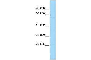 Host: Rabbit Target Name: PATL2 Sample Type: Hela Whole Cell lysates Antibody Dilution: 1. (PATL2 抗体  (C-Term))