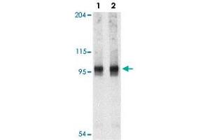 Western blot analysis of NARP2 in PC-3 cell lysate with NLRP2 polyclonal antibody  at 1 and 2 ug/mL . (NLRP2 抗体  (C-Term))