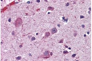 Human Brain, Cortex: Formalin-Fixed, Paraffin-Embedded (FFPE) (ACSL4 抗体  (N-Term))