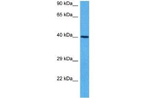 Host:  Mouse  Target Name:  GNAS  Sample Tissue:  Mouse Heart  Antibody Dilution:  1ug/ml (GNAS 抗体  (N-Term))