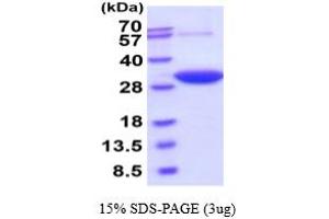 SDS-PAGE (SDS) image for Dicarbonyl/L-Xylulose Reductase (DCXR) (AA 1-244) (Active) protein (His tag) (ABIN6387971) (DCXR Protein (AA 1-244) (His tag))