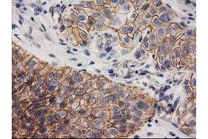 Image no. 2 for anti-Catenin (Cadherin-Associated Protein), beta 1, 88kDa (CTNNB1) antibody (ABIN1496889) (CTNNB1 抗体)