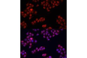 Immunofluorescence analysis of HeLa cells using Y antibody (ABIN6132789, ABIN6150317, ABIN6150322 and ABIN6215136) at dilution of 1:100. (YAP1 抗体  (AA 155-504))