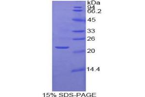 SDS-PAGE analysis of Human MMP1 Protein. (MMP1 蛋白)