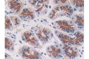 DAB staining on IHC-P; Samples: Human Stomach Tissue (ACP5 抗体  (AA 79-318))