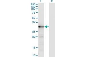 Western Blot analysis of TYMS expression in transfected 293T cell line by TYMS monoclonal antibody (M02), clone 2B2. (TYMS 抗体  (AA 111-210))