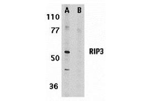 Western Blotting (WB) image for anti-Myosin Phosphatase rho Interacting Protein (MPRIP) antibody (ABIN1031778) (MPRIP 抗体)
