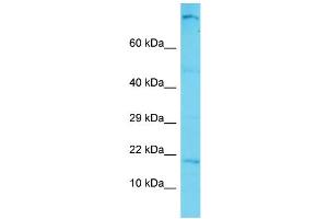 Host: Rabbit Target Name: C12orf74 Sample Type: Hela Whole cell lysates Antibody Dilution: 1. (C12ORF74 抗体  (N-Term))