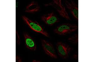 Immunofluorescent staining of HeLa cells with ANLN monoclonal antibody, clone CL0303  (Green) shows cell cycle dependent nuclear (without nucleoli) staining. (Anillin 抗体)