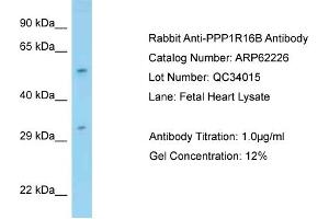 Western Blotting (WB) image for anti-Protein Phosphatase 1, Regulatory Subunit 16B (PPP1R16B) (N-Term) antibody (ABIN2774338) (PPP1R16B 抗体  (N-Term))