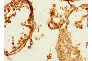 Immunohistochemistry of paraffin-embedded human testis tissue using ABIN7161113 at dilution of 1:100 (nectin-3 抗体  (AA 310-549))