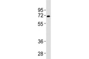 Western blot testing of SPHK2 antibody at 1:2000 dilution + human liver lysate (SPHK2 抗体  (N-Term))