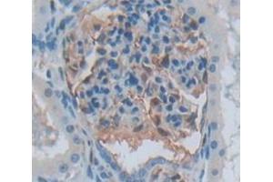 Used in DAB staining on fromalin fixed paraffin- embedded Kidney tissue (Aurora Kinase C 抗体  (AA 92-339))