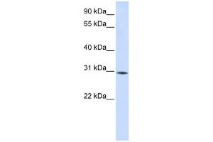 RBM7 antibody used at 1 ug/ml to detect target protein. (RBM7 抗体  (Middle Region))