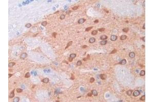 Immunohistochemistry (IHC) image for anti-Hepatocyte Growth Factor (Hepapoietin A, Scatter Factor) (HGF) (AA 306-471) antibody (ABIN7430570)