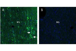 Stromal interaction molecule 2 (STIM2) in rat medial septum (MS) regionA. (Stim2 抗体  (Intracellular))