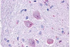 Immunohistochemical staining of human brain, neurons and glia with CHRM4 polyclonal antibody . (CHRM4 抗体  (Cytoplasmic Domain))