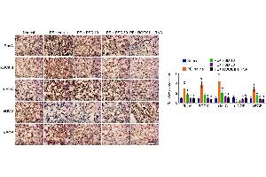 IHC analyzes the expression of RhoA, ROCK, p-MLC, eNOS and VEGF in placenta from PE miceRepresentative images of IHC staining for RhoA, ROCK, p-MLC, eNOS and VEGF (left), and quantification (right). (VEGFA 抗体  (AA 81-132))