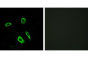 Peptide - +Western blot analysis of extracts from Jurkat cells, using EDG7 antibody. (LPAR3 抗体  (Internal Region))