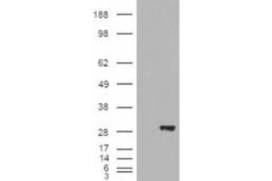 HEK293 overexpressing BDH2 (RC210586) and probed with ABIN238652 (mock transfection in first lane), tested by Origene. (BDH2 抗体  (Internal Region))