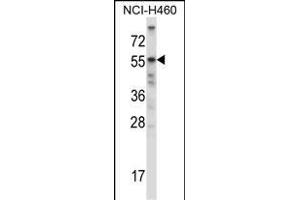 Mouse Acvr2b Antibody (Center) (ABIN657829 and ABIN2846796) western blot analysis in NCI- cell line lysates (35 μg/lane). (ACVR2B 抗体  (AA 148-176))
