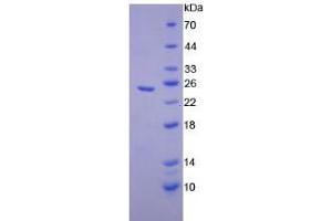 SDS-PAGE analysis of Mouse Elastase 1, Pancreatic Protein. (CELA1 蛋白)