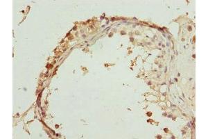 Immunohistochemistry of paraffin-embedded human testis tissue using ABIN7168463 at dilution of 1:100 (RUFY2 抗体  (AA 396-655))