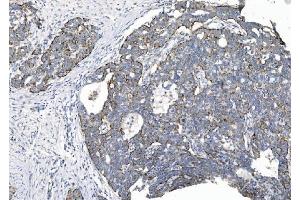 IHC analysis of CHCHD10 using anti-CHCHD10 antibody (ABIN7602507). (CHCHD10 抗体  (AA 80-142))