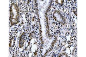 IHC analysis of ZMYND8 using anti-ZMYND8 antibody (ABIN7598947).