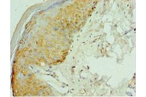 Immunohistochemistry of paraffin-embedded human skin tissue using ABIN7167058 at dilution of 1:100