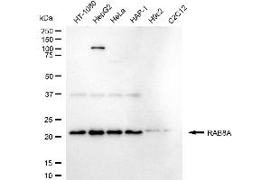 Western blotting analysis using RAB8A antibody (ABIN7800105).