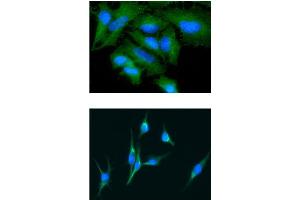 ICC/IF analysis of GAS7 in HeLa cells line, stained with DAPI (Blue) for nucleus staining and monoclonal anti-human GAS7 antibody (1:100) with goat anti-mouse IgG-Alexa fluor 488 conjugate (Green). (GAS7 抗体)