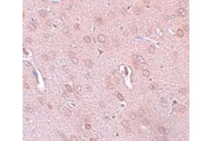 Immunohistochemical staining of rat brain tissue with KCNK18 polyclonal antibody  at 5 ug/mL dilution.