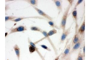 Immunocytochemistry (ICC) image for anti-Chaperonin Containing TCP1, Subunit 4 (Delta) (CCT4) antibody (ABIN4952801)