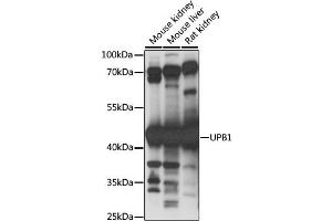 Western blot analysis of extracts of various cell lines, using UPB1 antibody. (UPB1 抗体)