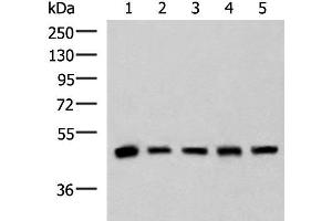 Western blot analysis of Human fetal liver tissue HepG2 A172 Hela and Jurkat cell lysates using PCYT2 Polyclonal Antibody at dilution of 1:800 (PCYT2 抗体)