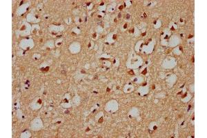 IHC image of ABIN7154372 diluted at 1:300 and staining in paraffin-embedded human brain tissue performed on a Leica BondTM system. (GRHL1 抗体  (AA 1-95))