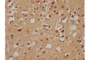 IHC image of ABIN7154372 diluted at 1:300 and staining in paraffin-embedded human brain tissue performed on a Leica BondTM system.