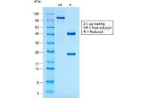 SDS-PAGE Analysis Purified ACTH Mouse Recombinant Monoclonal Antibody (r57). (Recombinant POMC 抗体  (N-Term))