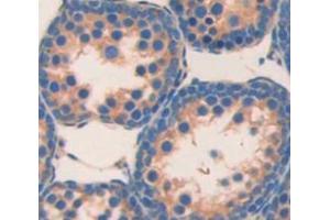 IHC-P analysis of Human Tissue, with DAB staining. (BCMO1 抗体  (AA 6-206))