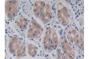 Detection of TLR5 in Human Stomach Tissue using Monoclonal Antibody to Toll Like Receptor 5 (TLR5) (TLR5 抗体  (AA 693-858))