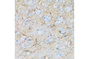 Immunohistochemistry of paraffin-embedded mouse brain using Versican Rabbit mAb (ABIN7271309) at dilution of 1:100 (40x lens). (Versican 抗体)
