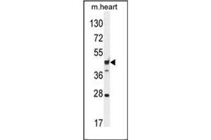 Western blot analysis of RILPL1 Antibody (C-term) in Mouse heart tissue lysates (35ug/lane). (RILPL1 抗体  (C-Term))