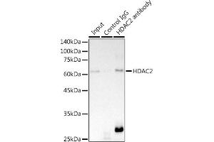 Immunoprecipitation analysis of 300 μg extracts of HeLa cells using 3 μg HD antibody (ABIN7267708).