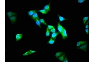 Immunofluorescence staining of Hela cells with ABIN7143957 at 1:133, counter-stained with DAPI. (ALMS1 抗体  (AA 889-1057))