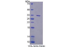 SDS-PAGE analysis of Human PLCd1 Protein. (PLCD1 蛋白)